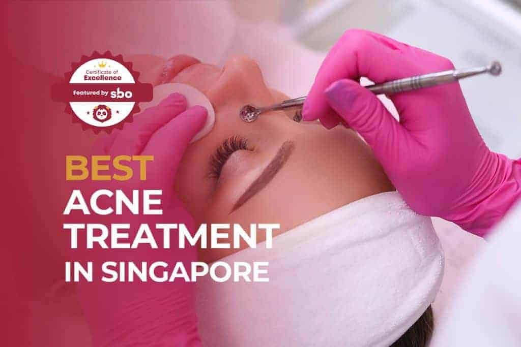 best acne treatment in singapore