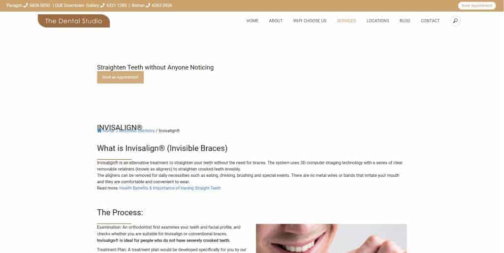 best invisalign in singapore_the dental studio