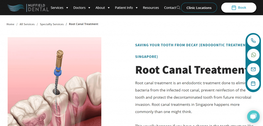 10 Best Root Canal Treatment in Singapore to Remove Inflamed Dental Pulp [2022] 4