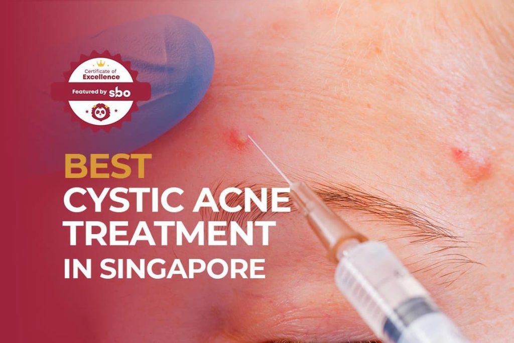 featured image_best cystic acne treatment in singapore