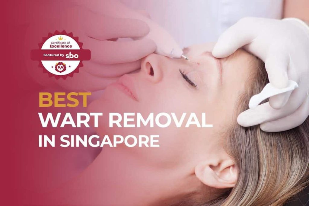 featured image_best wart removal in singapore